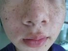 要获得完美肌肤，这就是您所需要的