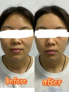 3D肌肉旋风塑形仪