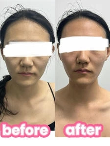 3D肌肉旋风塑形仪