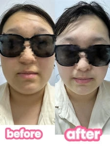 3D肌肉旋风塑形仪