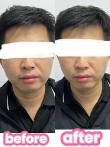 3D肌肉旋风塑形仪