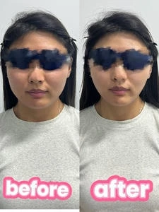 3D肌肉旋风塑形仪