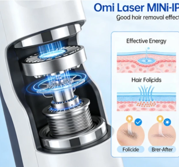 IPL(第五部分)|手持IPL能真正提供接近专业的效果吗?