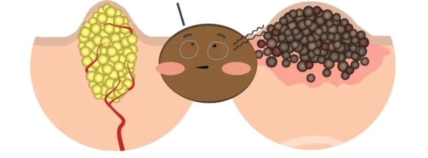 氧气泡泡面膜系列(第五部分)为什么“洁面护理”也必须消毒?(核心:臭氧/等离子体)