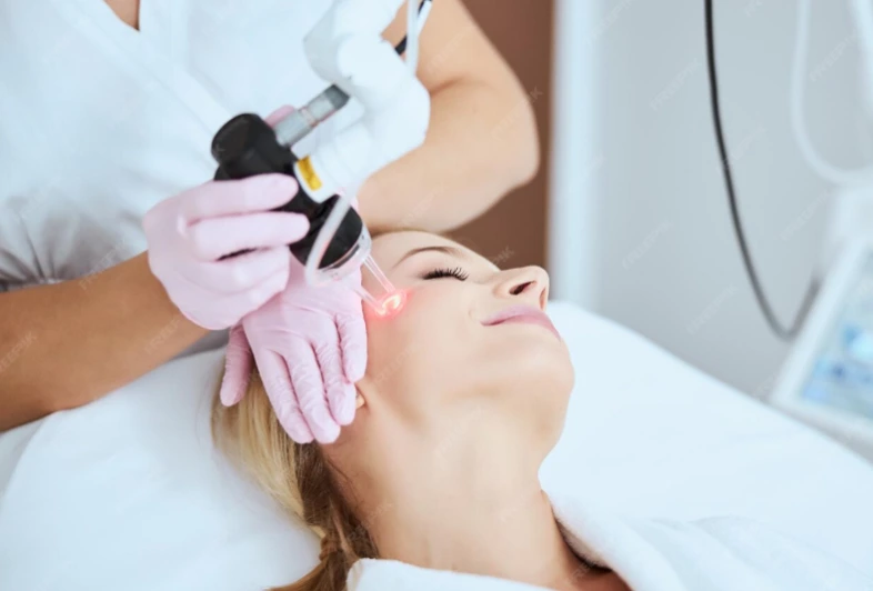 部分CO2激光治疗顶级皮肤问题:为什么诊所选择这项技术