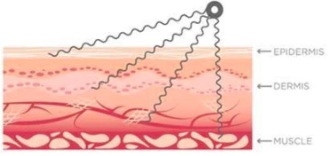 缓解肌肉疼痛和酸痛与三维旋风波系统：机制，效益和科学