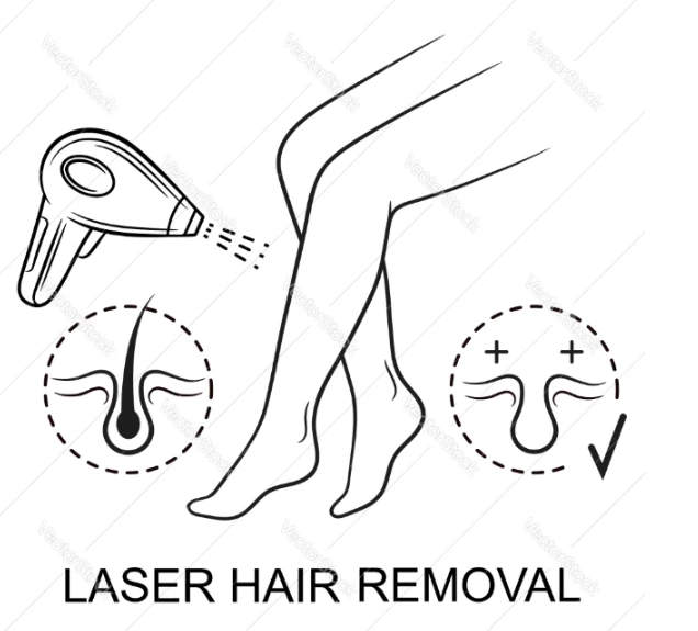 无痛激光脱毛：是什么让808二极管激光舒适和有效