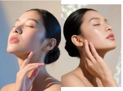 手持式HIFU系列（四）为什么有些人接受超疗后效果不明显？-治疗后的“修复和激活”是关键